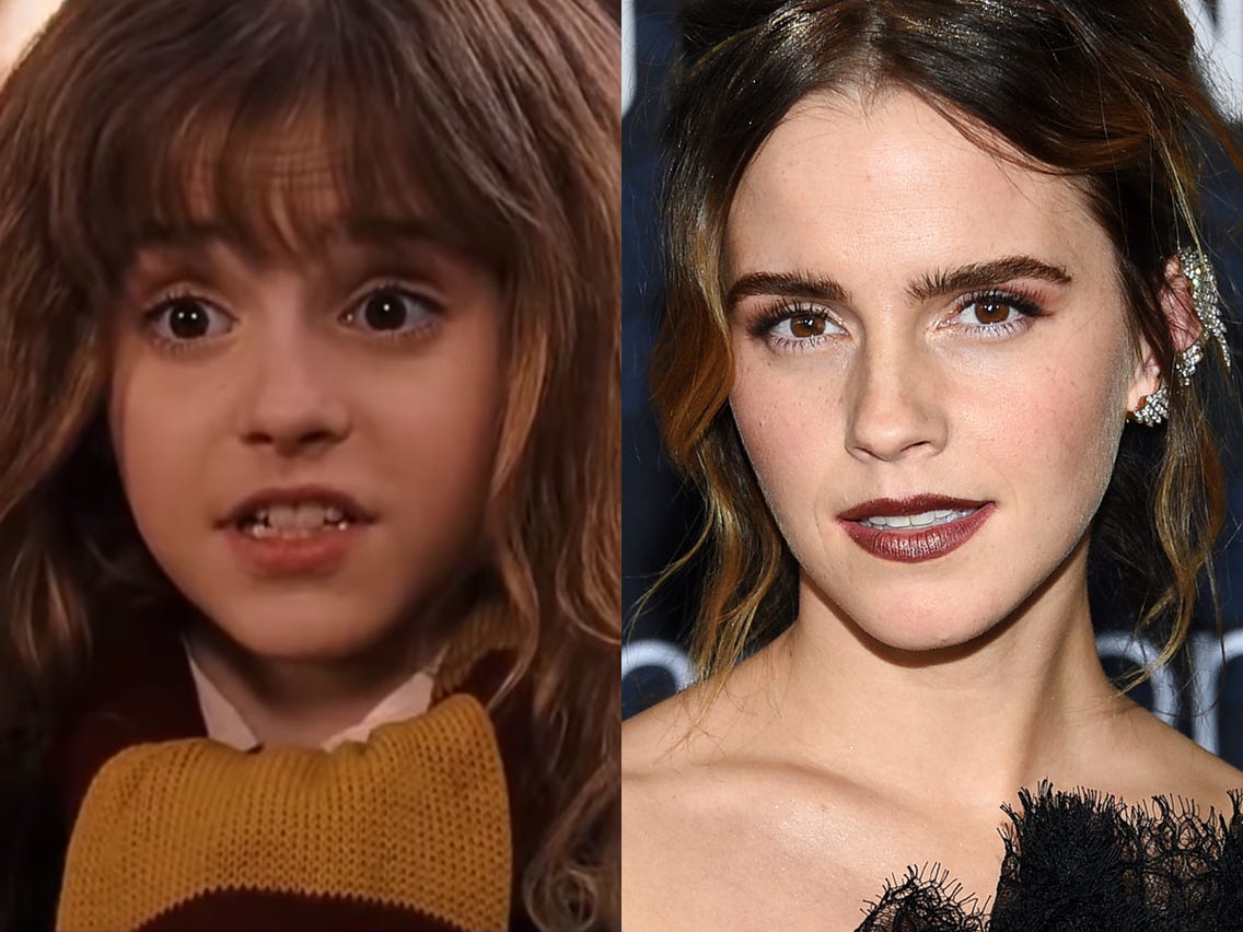From Muggles to Icons: The Harry Potter Cast's Journey